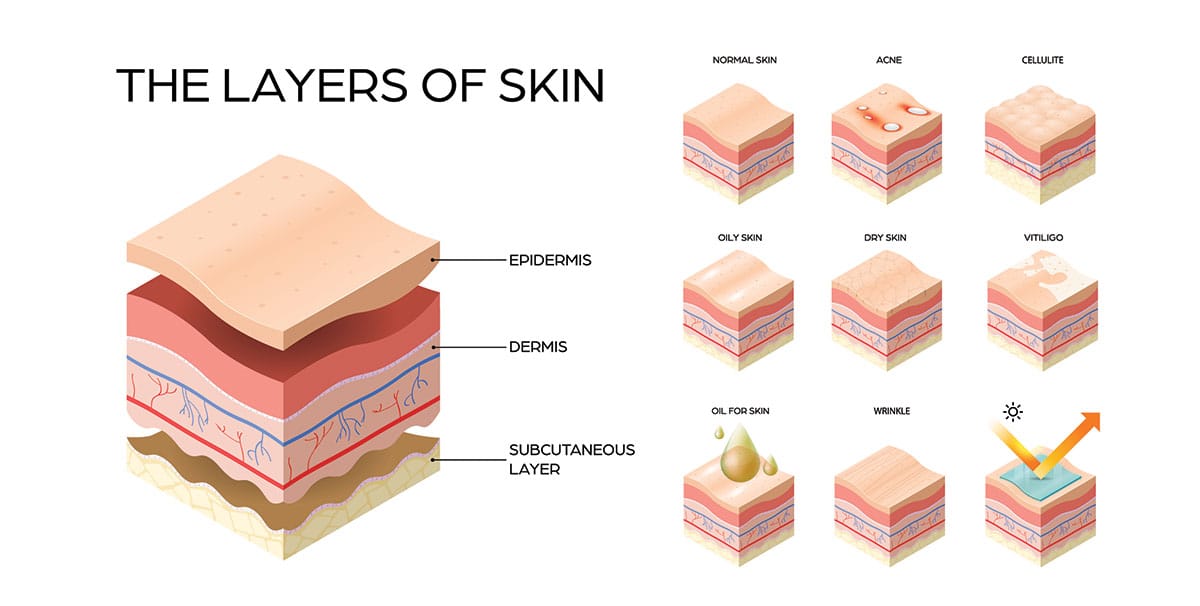 Graphic showing the skin’s layers